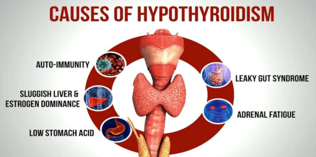 Hypothyroidism symptoms