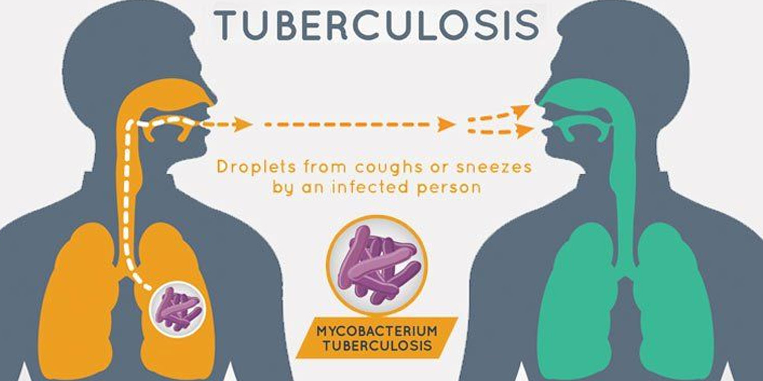 Tuberculosis-TB के मामले दुनिया भर में पहली बार इस साल में बढ़ा