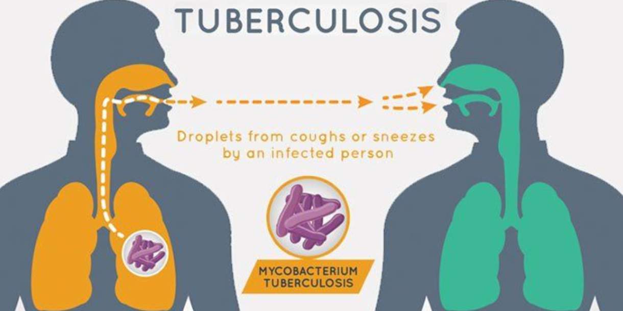 Tuberculosis-TB के मामले दुनिया भर में पहली बार इस साल में बढ़ा