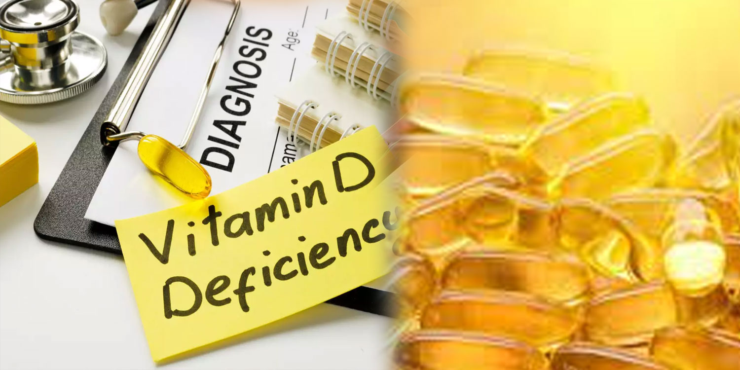 Vitamin D Deficiency Disease Treatment