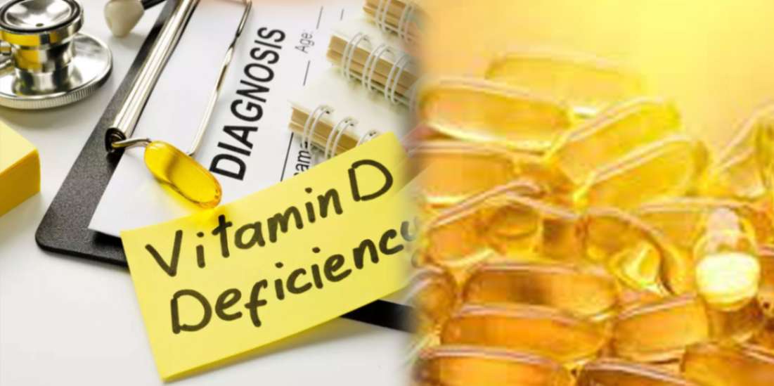 Vitamin D Deficiency Disease Treatment